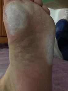 国产脚底角质去除视频,国产去角质视频教程大揭秘  第3张